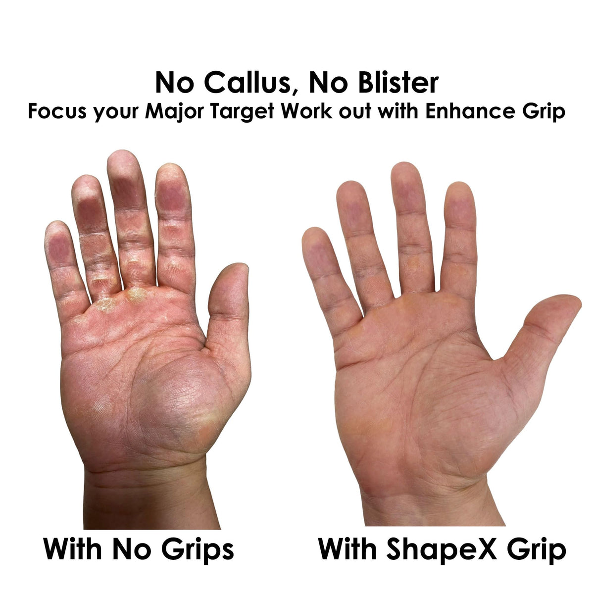 ShapeX Pull up Hand Grip for Men and Women - Weight Lifting Straps for Deadlift - Replacement for Versa, Crossfit Grips - Gym Hand Strap for Excercise and Gymnastics